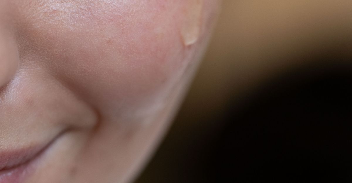 Retinol v Sloveniji: kdaj začeti in kdaj počakati